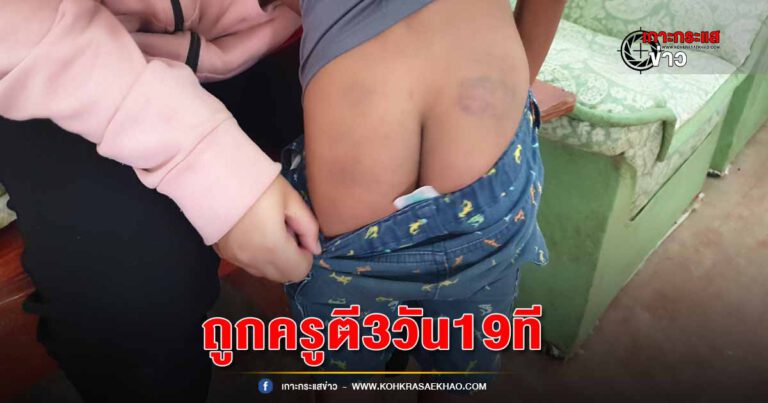 เพชรบุรี-ผู้ปกครอง ป.3 ร้องลูกชายถูกครู 3 คน ตี 3วันติด 19ครั้ง ทำบาดเจ็บไม่ยากไปโรงเรียนโร่แจ้งความเอาผิด